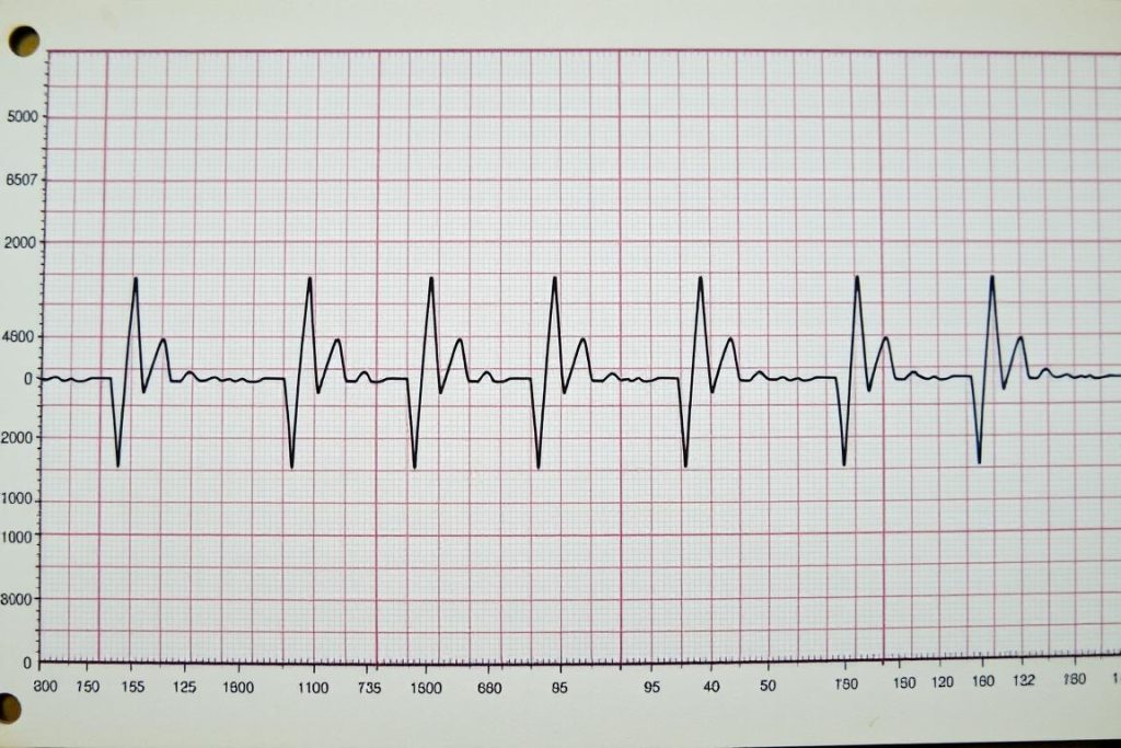 Wykres sfigmograficzny pokazujący zapis tętna